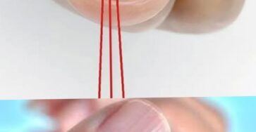 linee verticali sulle unghie