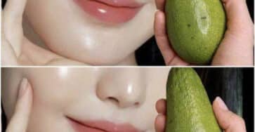 avocado per pelle giovane