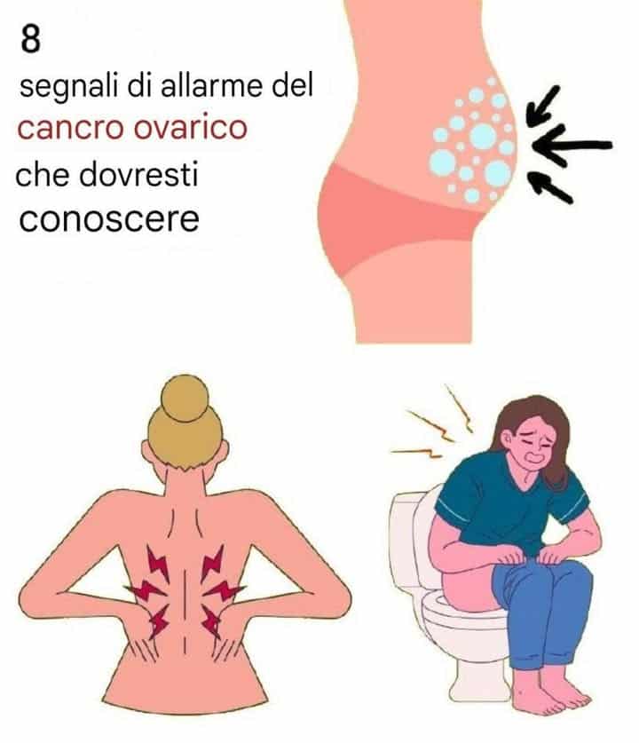 cancro ovarico allerta segnali
