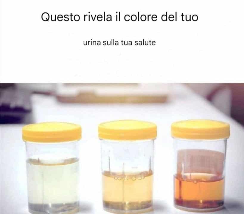 colore urina salute salute