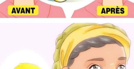 limone rughe profondo eliminare