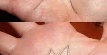 linee della mano