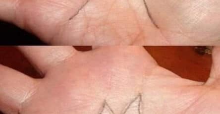linee della mano