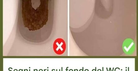 macchie nere water trucco