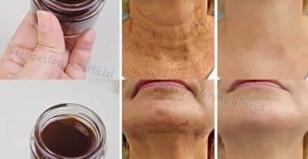 olio di caffè rughe