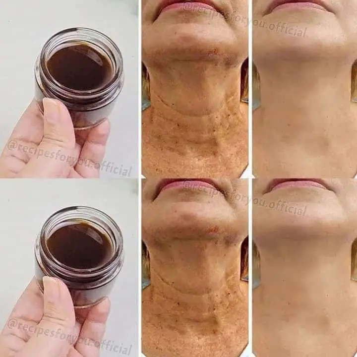 olio di caffè rughe