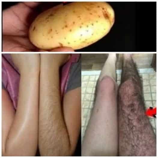 peli di viso patata