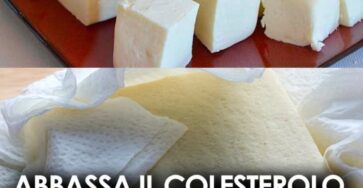 privo di lattosio colesterolo