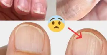 problemi salute unghie