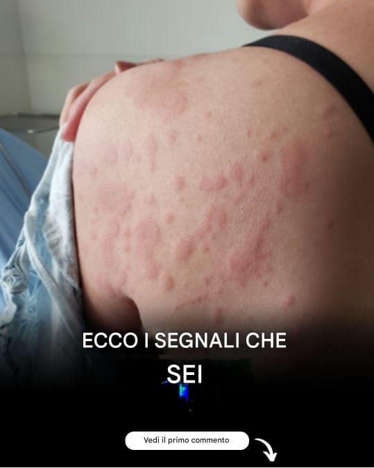prurito corpo allergia