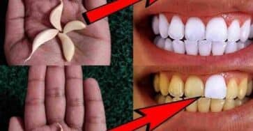 sbiancare denti aglio metodo