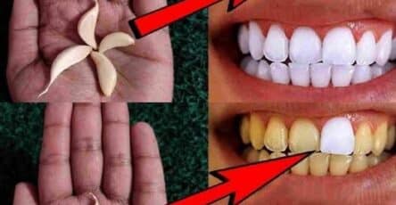 sbiancare denti aglio metodo