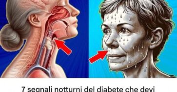 segnali diabete notturno