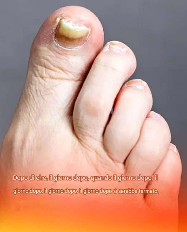 segni impercettibili piedi