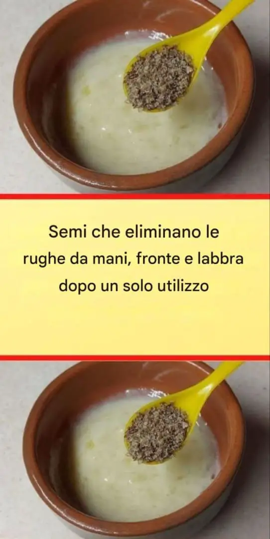 siero rimozione rughe mani