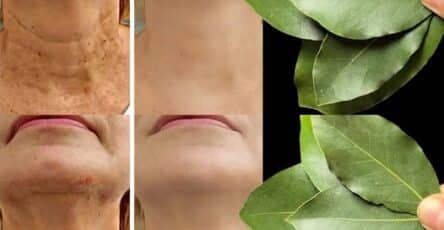 Antirughe naturale efficace