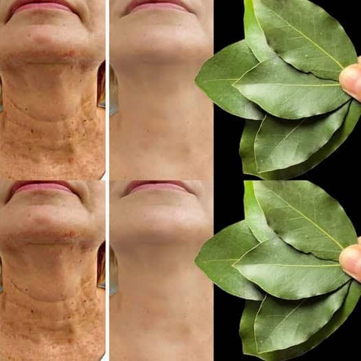 Antirughe naturale efficace