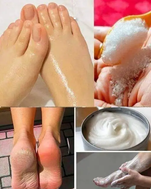 Bicarbonato per pedicure