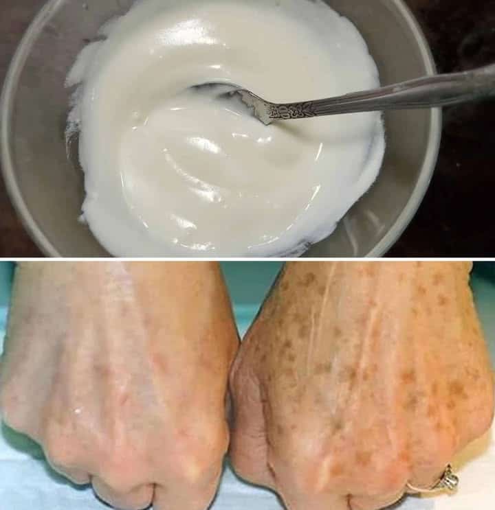 Crema ringiovanente per mani