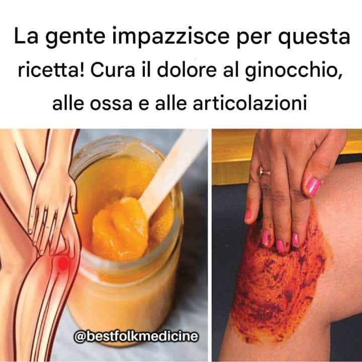 Cura dolore ginocchio