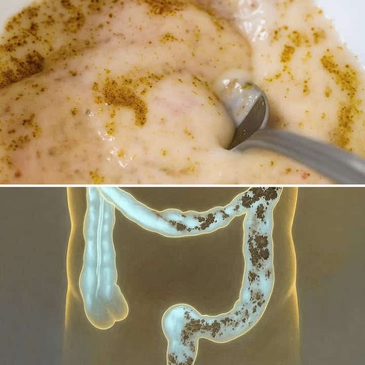 Purificazione del colon veloce