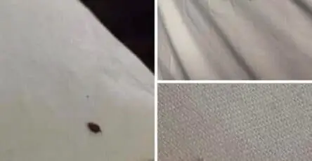 Ridurre Punti Neri Tessuti