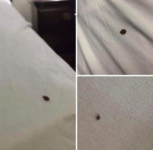 Ridurre Punti Neri Tessuti
