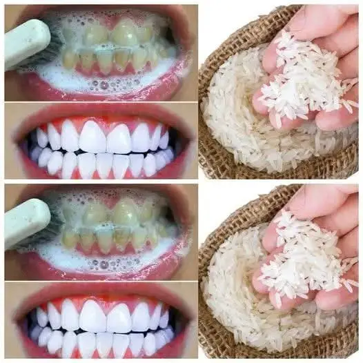 Sbianca i denti velocemente