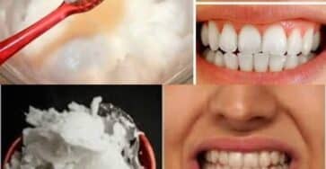 Sbiancare i denti naturalmente