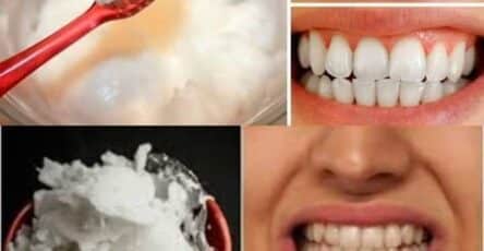 Sbiancare i denti naturalmente