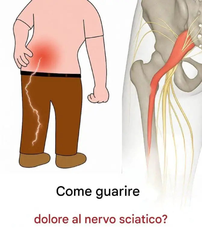 alleviare dolore sciatico gambe