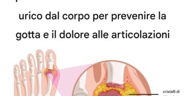 cristallizzazione acido urico
