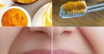 curcuma salute dentale