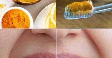 curcuma salute dentale