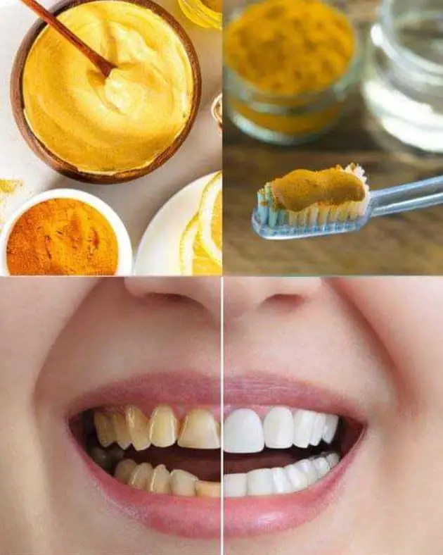 curcuma salute dentale