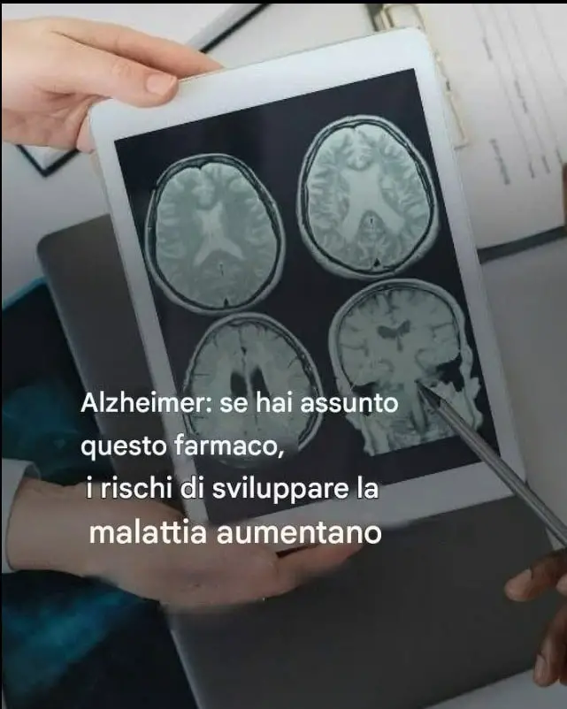 farmaco morbo di Alzheimer