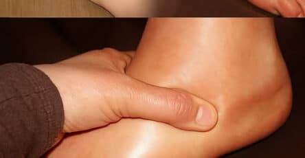gonfi mani piedi rimedi