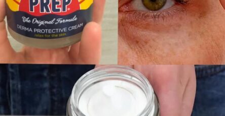 metodi alternativi crema Prep