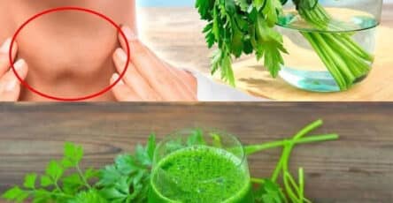 prezzemolo e cura naturale