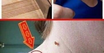 rimedi naturali pelle sana