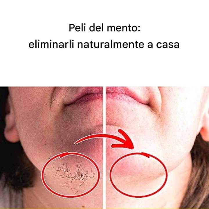 rimuovere peli del mento