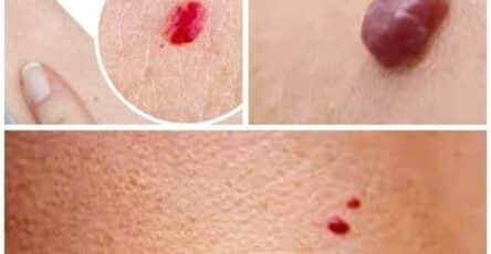 rosso segnale corpo
