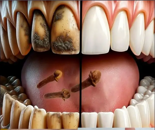sbiancamento denti casa