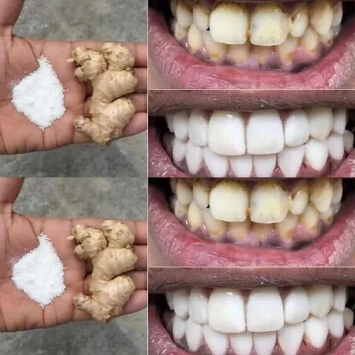 sbiancamento denti veloce naturale