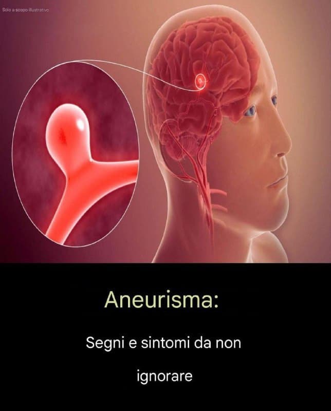 segnali d'allarme aneurisma