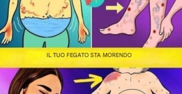 segnali fegato salute problemi