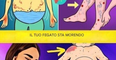 segnali fegato salute problemi