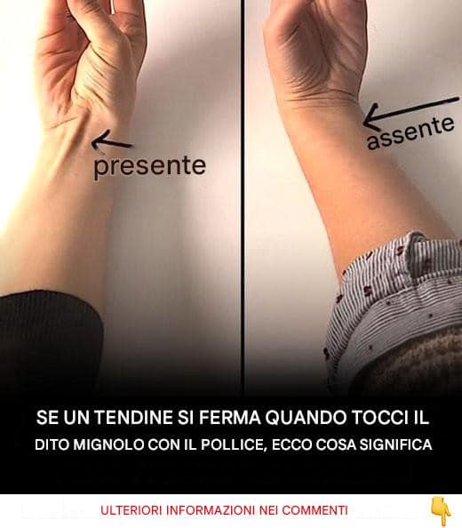 tendine scoppia mignolo pollice