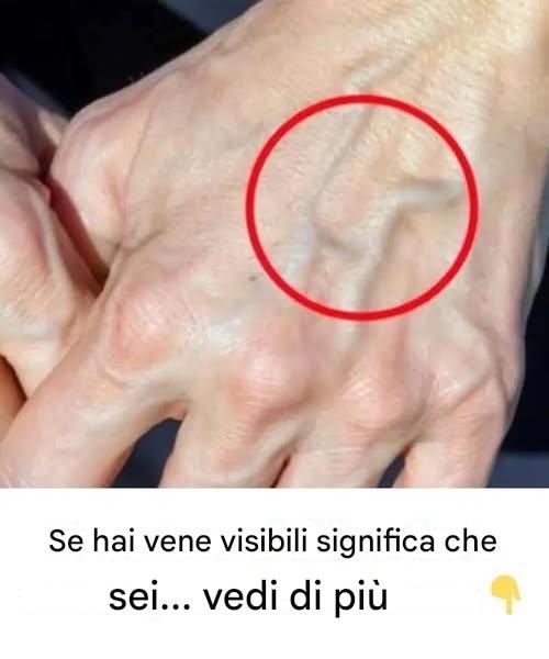 vene visibili significano salute